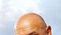 Si sufres alopecia, esto te interesa; EU aprueba píldora para su tratamiento