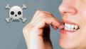 ¿Qué es la gingivitis? Causas, síntomas y tratamiento: Dentista