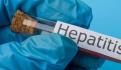 Reportan tres casos sospechosos de hepatitis aguda infantil en Jalisco y Oaxaca
