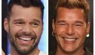 Ricky Martin rompe el silencio y revela la razón de su cara "operada"