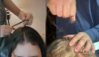 El reto del 'estallido del cuero cabelludo' es peligroso para la salud incluso a largo plazo