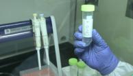 Vacuna contra el virus SARS-CoV-2 desarrollada por el IMSS