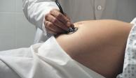 Médicos que realicen abortos a mujeres con un feto con síndrome de Down perderán su licencia.