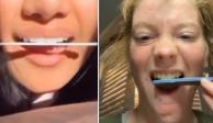 Reto viral de limarse los dientes para "emparejarlos"