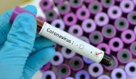 Análisis clínicos para encontrar la vacuna contra el coronavirus.