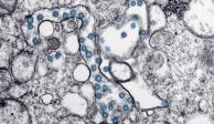 Partículas del virus SARS-CoV-2, coloreadas en azul, en una imagen de microscopio de electrones.
