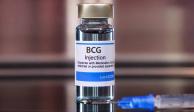 Hubo escasez mundial de la vacuna BCG, pero también los esfuerzos de laboratorios se centraron en el Covid, dice especialista.