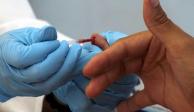 México participa en ensayo contra el VIH