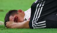 "Chucky" Lozano sufre una escalofriante lesión en la Copa Oro.