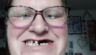 La mujer se retiró los dientes ella sola pues no puede pagar un tratamiento