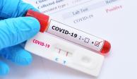 El gobierno de la CDMX alerta ante pruebas COVID-19 no autorizadas por la Cofepris..