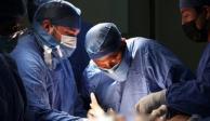 IMSS calificó indispensable mejorar la productividad en trasplante de órganos.