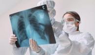 Casos de tuberculosis en México aumentan 45.3 por ciento.