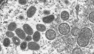 Imagen de microscopía electrónica&nbsp;muestra partículas maduras del virus de la viruela del mono; EU reporta su primer caso en Massachusetts.&nbsp;