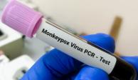 Prueba PCR de viruela del mono.