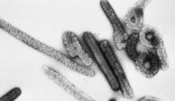 Imagen microscópica del virus de Marburgo.