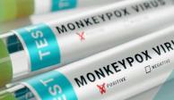 Reportan 31 casos confirmados de viruela del mono en la CDMX