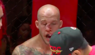 La nariz de Blake Perry durante su pelea en  A1 Combat Series que pasan por UFC Fight Pass