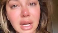 Chiquis Rivera se tatúa mal los labios y se le hincha toda la boca (FOTOS)