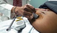 Un doctor usa una sonda manual Doppler para medir el latido de un feto, en Jackson, Mississippi)