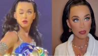 Katy Perry causó preocupación por su ojo
