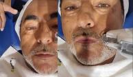Raúl Araiza presume cómo le arreglan la cara (VIDEO)