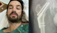 Kevin Parker de Tame Impala se fractura la cadera ¿Qué pasará con conciertos en México?