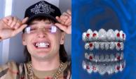 Peso Pluma: ¿Cuánto cuesta su nueva dentadura de diamantes?