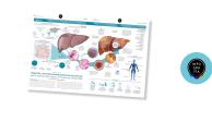 Hepatitis, una enfermedad silenciosa más mortal que la malaria, tuberculosis y VIH juntos en 2040: OMS<br>