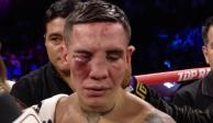 El rostro de Óscar Valdez luego de la pelea ante Emanuel 'Vaquero' Navarrete