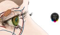 ¿Síndrome del ojo seco? Lo padecen tres de cada 10 personas en el mundo