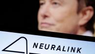 Neuralink implanta chip cerebral en el primer ser humano, anuncia Elon Musk.
