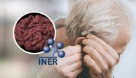 La pérdida de audición podría estar relacionada con el Alzheimer y esta es la razón.