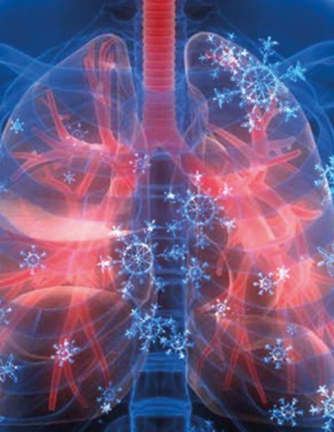 Aumenta 42% la incidencia de enfermedades respiratorias