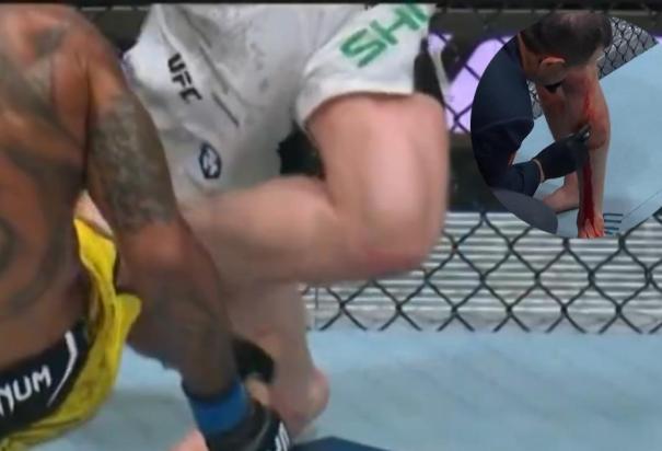 El galés Jack Shore sufrió un terrible corte en la pierna en UFC 301.