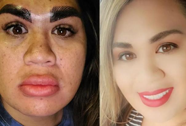 "Me destrozaron la cara": Mujer paga más de 7 mil pesos por microblading y así la dejaron