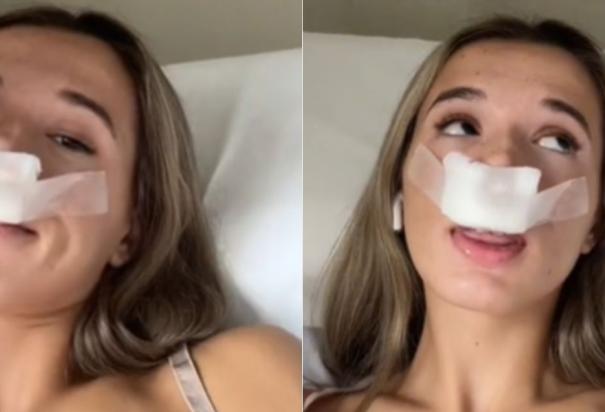 Una influencer se operó la nariz para heredarle a sus hijos una estética bonita; usuarios se burlaron.