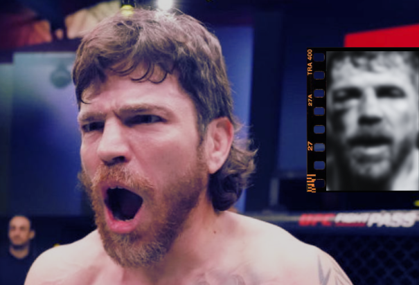 Jim Miller muestra las fracturas que sufrió en la UFC 300