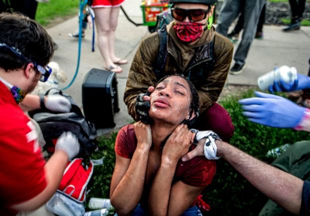 Un manifestante recibe atención de médicos de la calle en Minneapolis, el sábado 30 de mayo de 2020.
