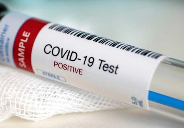 Las pruebas de Covid continúan aplicándose para detectar la enfermedad.