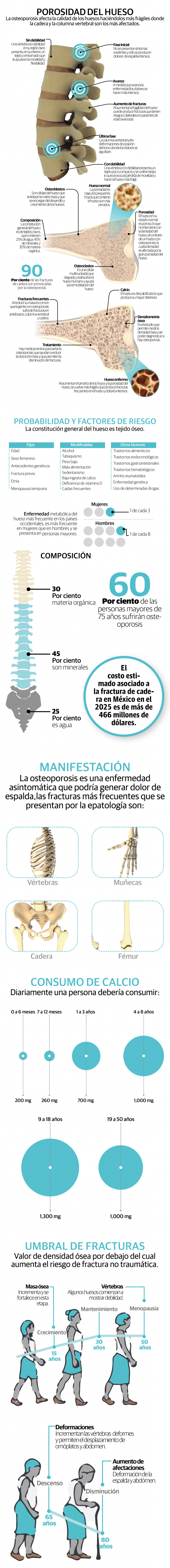 Osteoporosis, la enfermedad que pone en riesgo a 24.5 millones de mexicanos