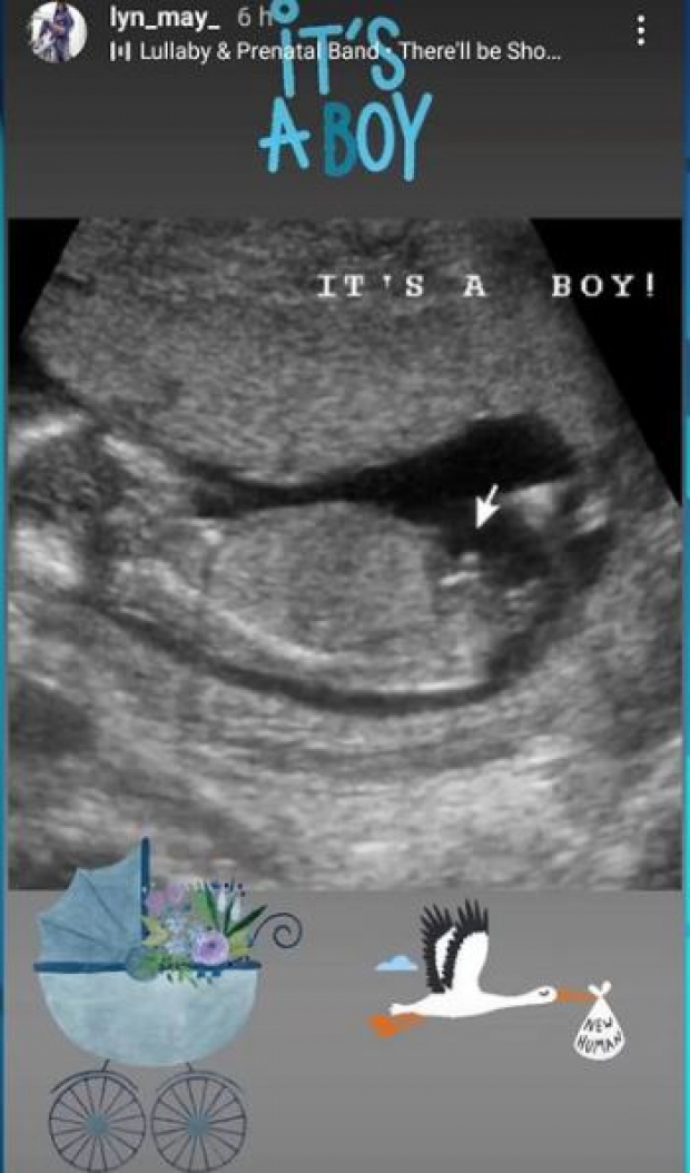 Lyn May comparte foto de ultrasonido de su supuesto bebé