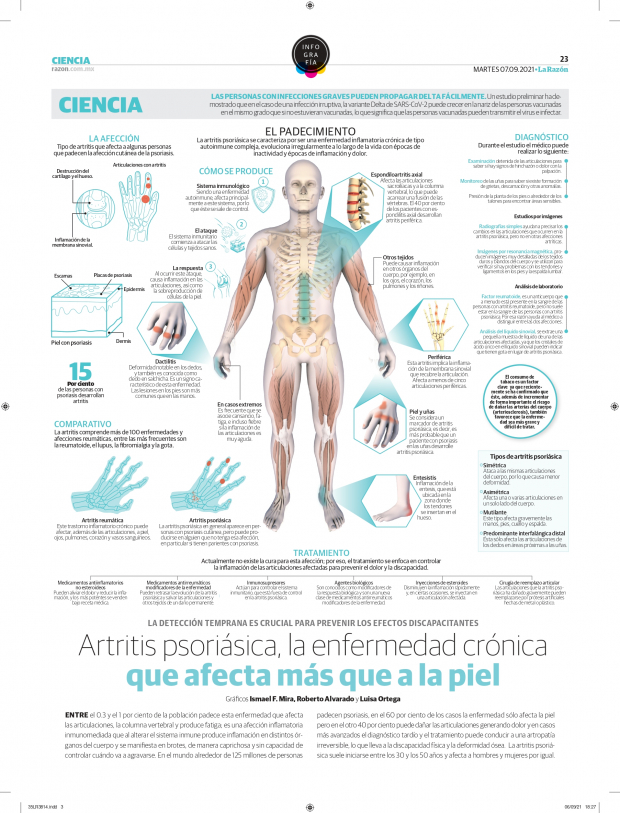 Artritis psoriásica, la enfermedad crónica que afecta más que a la piel