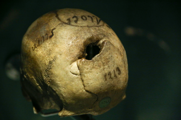 Cráneo atribuido al gobernante Moctezuma.