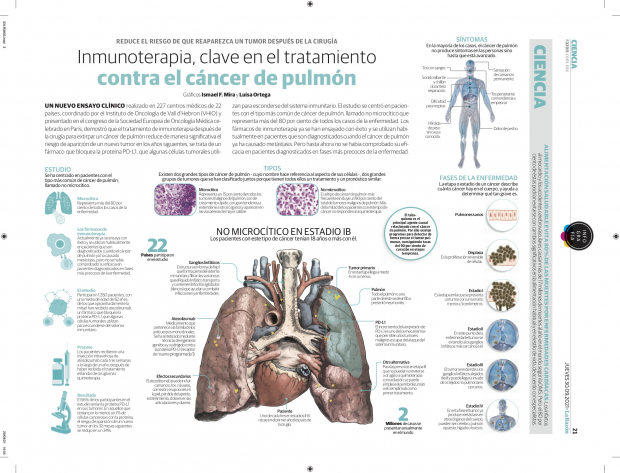 Inmunoterapia, clave en el tratamiento contra el cáncer de pulmón