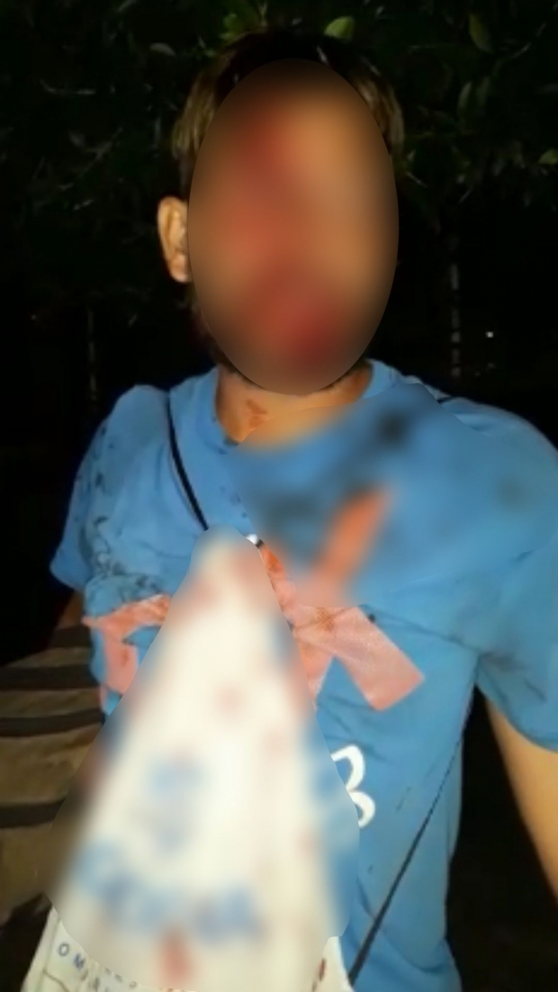 Migrante golpeado en Chiapas.