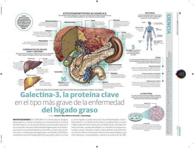 Galectina-3, la proteína clave en el tipo más grave de la enfermedad del hígado graso