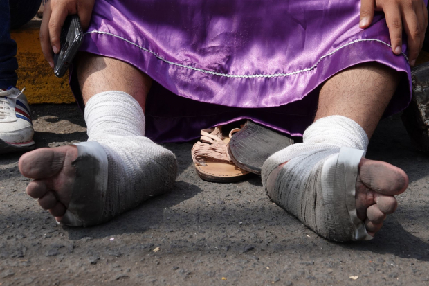 La imagen muestra los pies vendados de un fiel que caminó por cerca de 4 horas en la 179 representación de la Pasión de Cristo en Iztapalapa