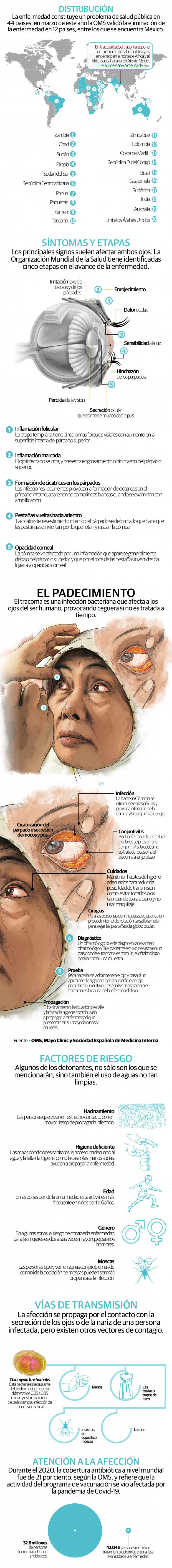 Tracoma, la enfermedad infecciosa que causa ceguera, aún es un problema en África y Asia