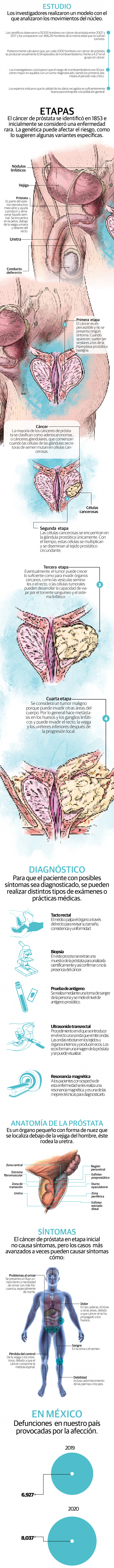 Cáncer de próstata; descubren mayor riesgo de trombo grave en los 5 primeros años tras diagnóstico